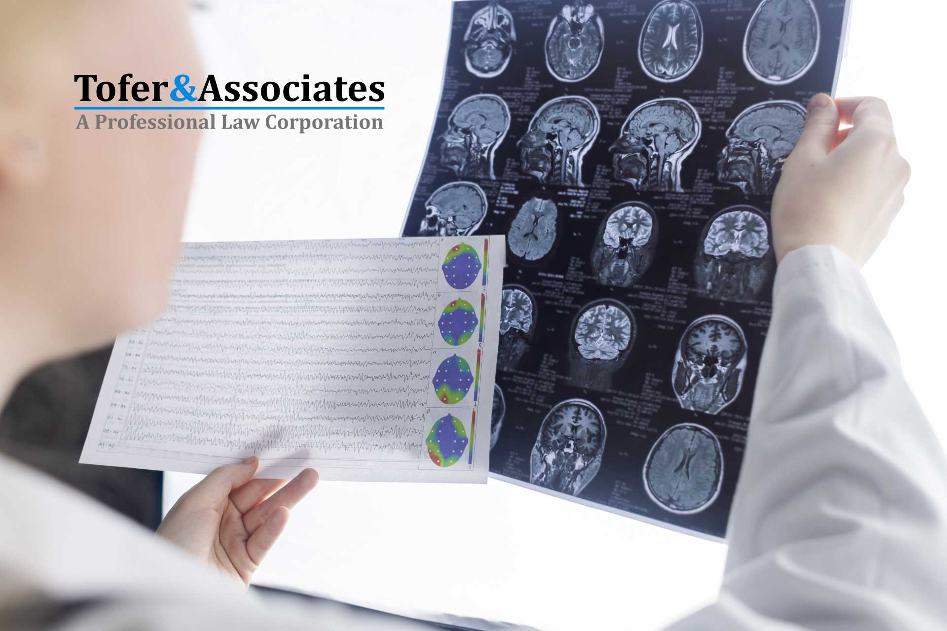 Navigating Brain Injury Claims [How Tofer & Associates Can Help]