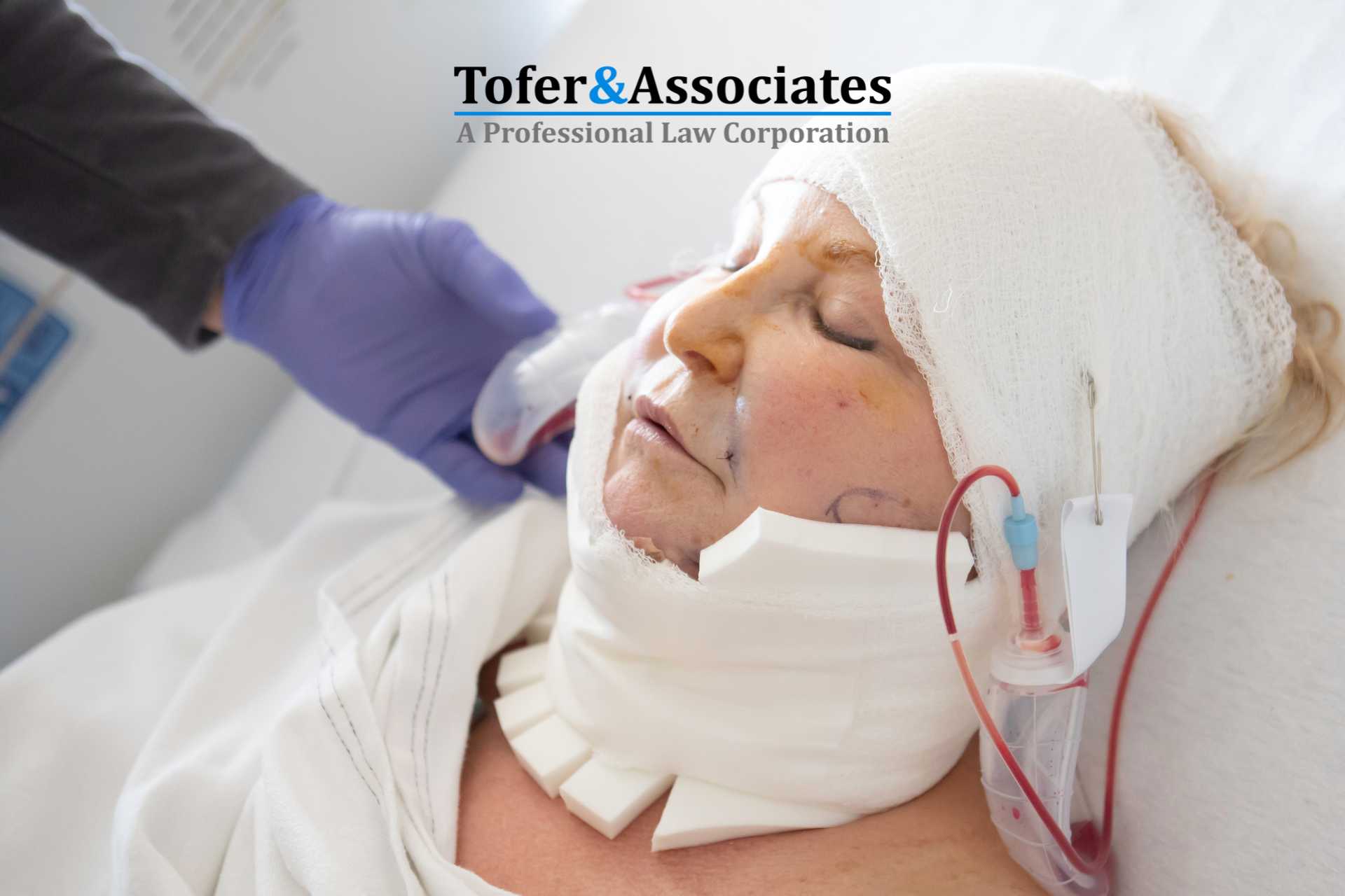 Understanding Traumatic Brain Injury Settlements in California
